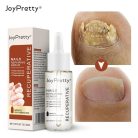 JoyPretty Skin® körömgomba elleni szérum – hatékony kezelés gombás körömre