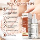 JoyPretty Skin® körömgomba elleni szérum – hatékony kezelés gombás körömre