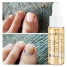 JoyPretty Skin® körömgomba elleni szérum – hatékony kezelés gombás körömre