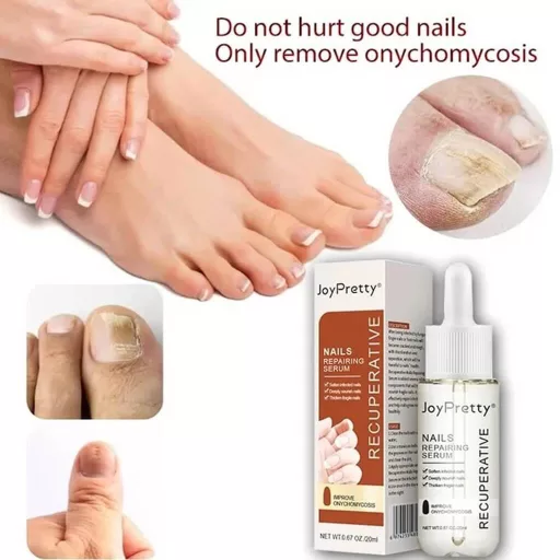 JoyPretty Skin® körömgomba elleni szérum – hatékony kezelés gombás körömre