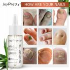 JoyPretty Skin® körömgomba elleni szérum – hatékony kezelés gombás körömre