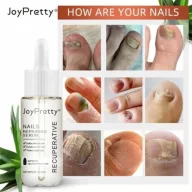JoyPretty Skin® körömgomba elleni szérum – hatékony kezelés gombás körömre