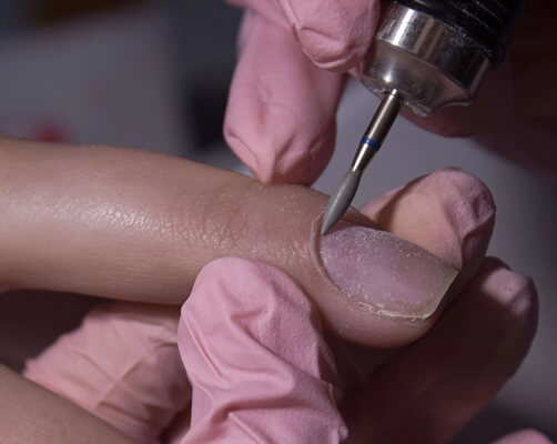 Kutikula védelmi szerepe és műköröm-allergia összefüggése