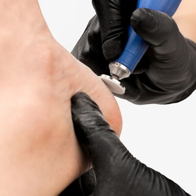 Pododisk készlet M pedikűrhöz